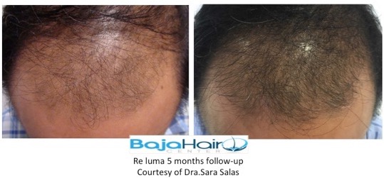 Hair1