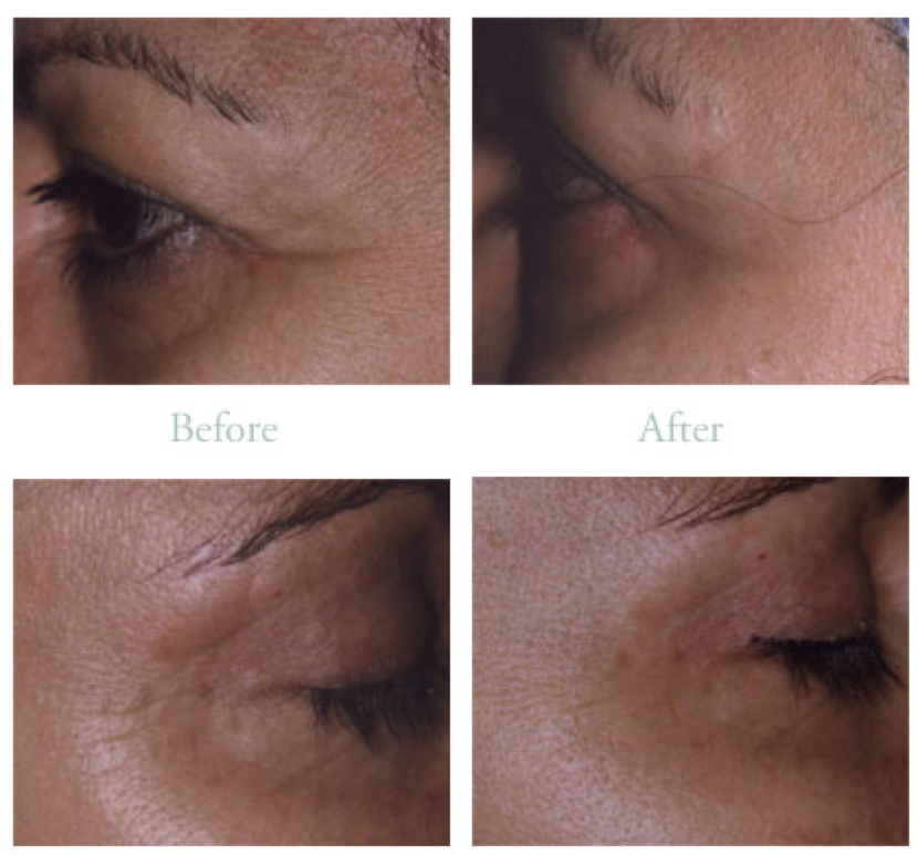 eyecream3